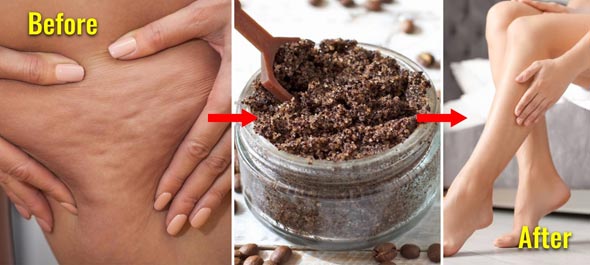 ماسک تفاله قهوه برای رفع سلولیت Coffee and cellulite mask